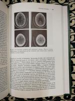 Behavioral Neurology: A Practical Approach Volume 7 (Clinical Neurology and Neurosurgery Monographs)