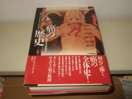 癌の歴史