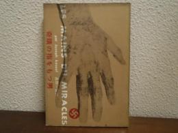奇蹟の指をもつ男