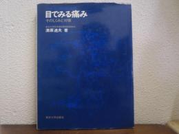 目でみる痛み : そのしくみと対策