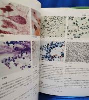 穿刺吸引細胞診アトラス