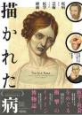 描かれた病