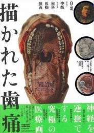 【未読品】 描かれた歯痛 : 白と黒、および神経からなる歯科医療挿画