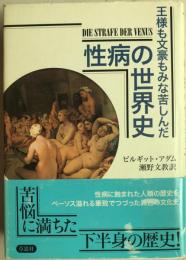 王様も文豪もみな苦しんだ性病の世界史