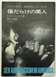傷だらけの黒人 : アメリカの人種差別とセックス
