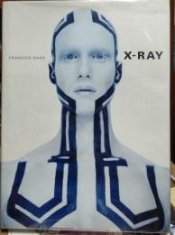 X-RAY