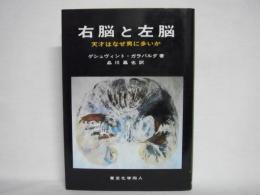 右脳と左脳 : 天才はなぜ男に多いか