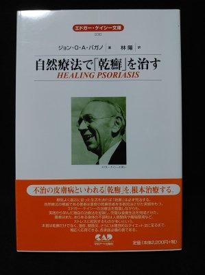 自然療法で「乾癬」を治す エドガー・ケイシー文庫 (ジョン・O.A.