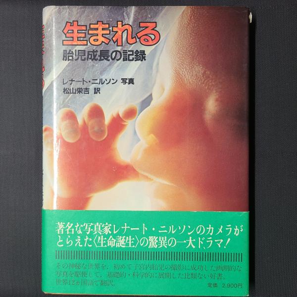 生まれる (胎児成長の記録) （370gで生まれた赤ちゃんのママ