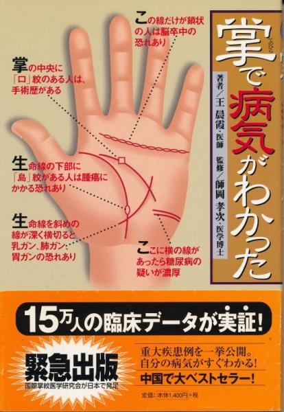 掌で病気がわかった | 王 晨霞, 孝次, 師岡 |本 | 通販 | Amazon