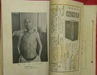 臨牀醫學研究　第一～四號　4冊