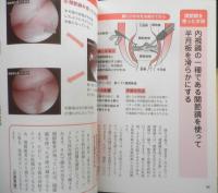 ここが聞きたい！名医にQ ひざの痛み　2009年初版　NHK出版　w