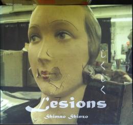 しくしく Lesions