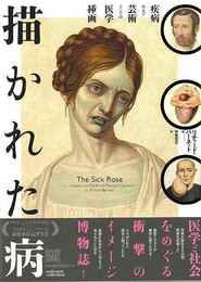 描かれた病－疾病および芸術としての医学挿画
