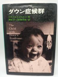 ダウン症候群