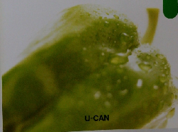 公衆衛生学　テキスト6