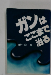 ガンはここまで 治る