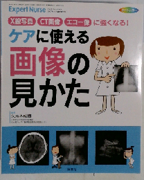 Ｘ線写真 ＣＴ画像 エコー像に強くなる！