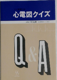 心電図クイズ