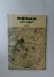 鼓室形成術 1型から0型まで