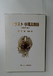 イラスト中耳真珠腫