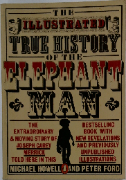 True History Of The Elephant Man