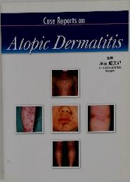 Case Reports on  Atopic Dermatitis