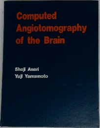 Computed Angiotomography of the Brain