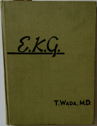 EKG