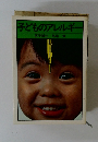 子どものアレルギー