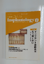 Quintessence DENTAL Implantology　2013年2月号