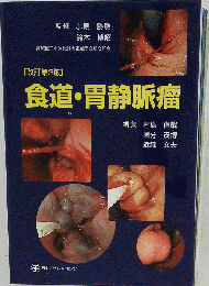 食道 胃静脈瘤