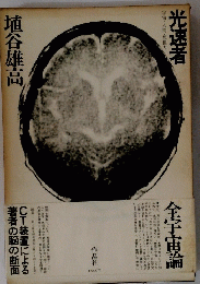 光速者　埴谷雄高
