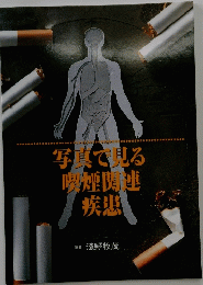 写真で見る喫煙関連疾患