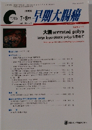 早期大腸癌　2006年8月号