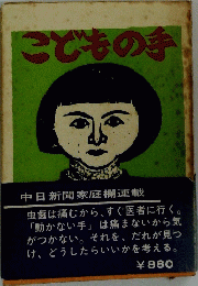 こどもの手