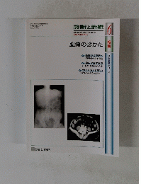 診断と治療　6