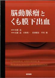 脳動脈瘤とくも膜下出血