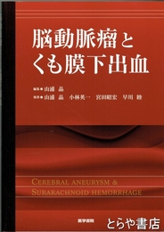 脳動脈瘤とくも膜下出血