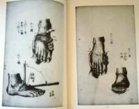 D20031012〇復刻漢方医学 繃帯要論  瘍医新書 手足切断篇  整形外科典籍体系 オリエント出版 １９８３年〇和本古書古文書