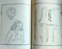 D20031006〇復刻漢方医学 紅夷外科宗伝 金瘡跌撲療治之畫書 外科訓蒙圖彙 身幹儀說 整骨 整形外科典籍体系 オリエント出版 １９８３年〇和本古書古文書