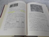 機械部材の破損解析