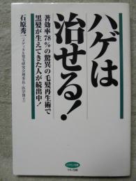 ハゲは治せる!