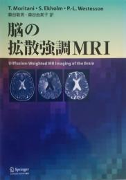 脳の拡散強調MRI