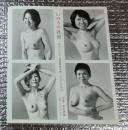 いのちの乳房ー乳がんにはによる「乳房再建手術」乳がんのぞんだ１９人