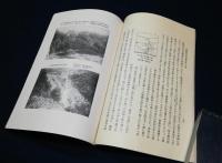 長野県犀川沿岸地方　地辷に就て