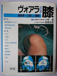 ヴォアラ膝 : 膝疾患への新しい展開