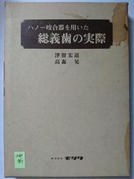 ハノー咬合器を用いた総義歯の実際