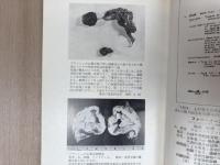 フィリピンの心霊手術