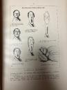 （独）ヨーロッパ市民のカリカチュア　エドゥアルト・フックス　1921年改訂版クロス装　全2巻　Die Karikatur der europaischen Volker. 2 Bde.